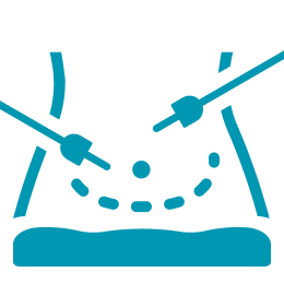 Sentinel Lymph Node Mapping Surgery